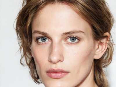 做了埋线双眼皮半个月了还肿是怎么回事双眼皮埋线做了半个月了还是肿