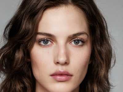 淄博金美医疗美容诊所整形价位表2025一览-下眼纹深去除案例