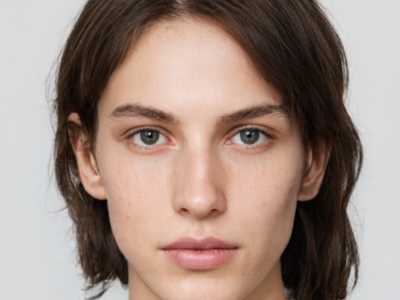 日照茶渍牙美白后遗症怎么避免