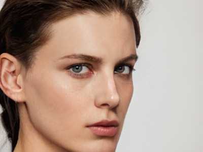 全切双眼皮一个月后，大家来看看自然不（全切双眼皮一个月会自然吗）