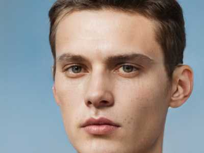 方跃明整形医生-运城市方跃明医生割双眼皮多褶上榜理由全面公布