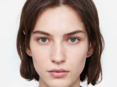 镭射去除妊娠纹有用吗(镭射去除妊娠纹的方法)