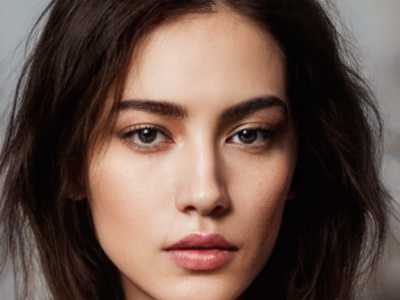 一侧的太阳穴塌陷是怎么回事一侧太阳凹陷怎么回事