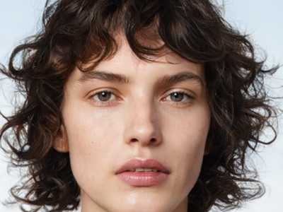 河北承德医学院附属医院整形美容科收费明细手术新版附眼角泪沟去除案例